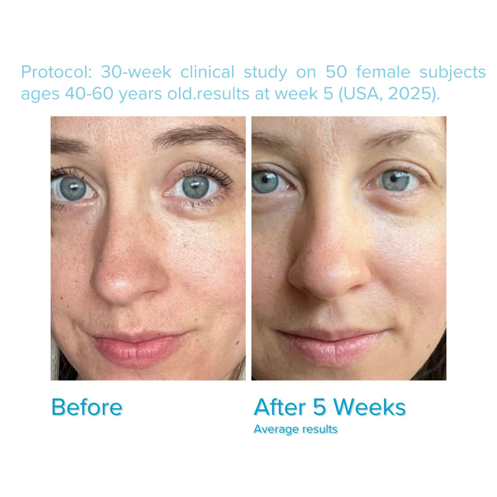 SkinovaCeuticals C E Ferulic with 15% L-Ascorbic Acid — Vitamin C Serum for Anti-Aging, Firming, and Brightening — 1.01 fl oz / 30 ml