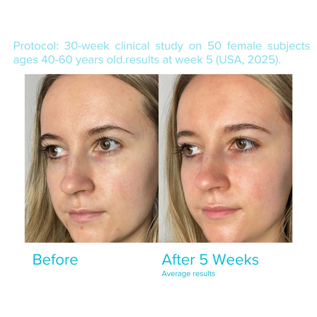 SkinovaCeuticals C E Ferulic with 20% L-Ascorbic Acid — Vitamin C Serum for Anti-Aging, Firming, and Brightening — 1.01 fl oz / 30 ml