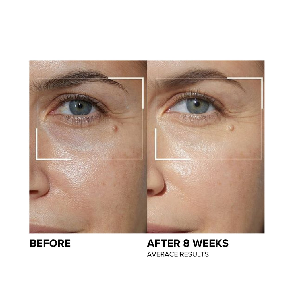 A.G.E. Advanced Eye for Dark Circles Eye cream for dark circles and wrinkles